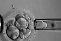 2026年上海瑞金医院做怀孕试管多少钱一次？附怀孕试管费用明细