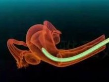 2026北医三院三代试管单周期费用明细汇总，了解每一笔支出